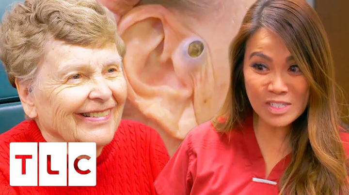 Dr. Lee Removes A Massive 55 Year Old Blackhead! |...