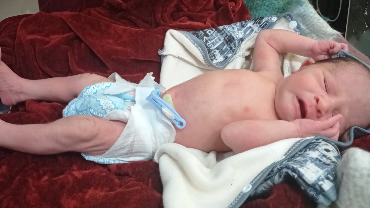 Newborn Baby Admission in NICU | Initial Assessment, Physiotherapy & Body Warmer Care