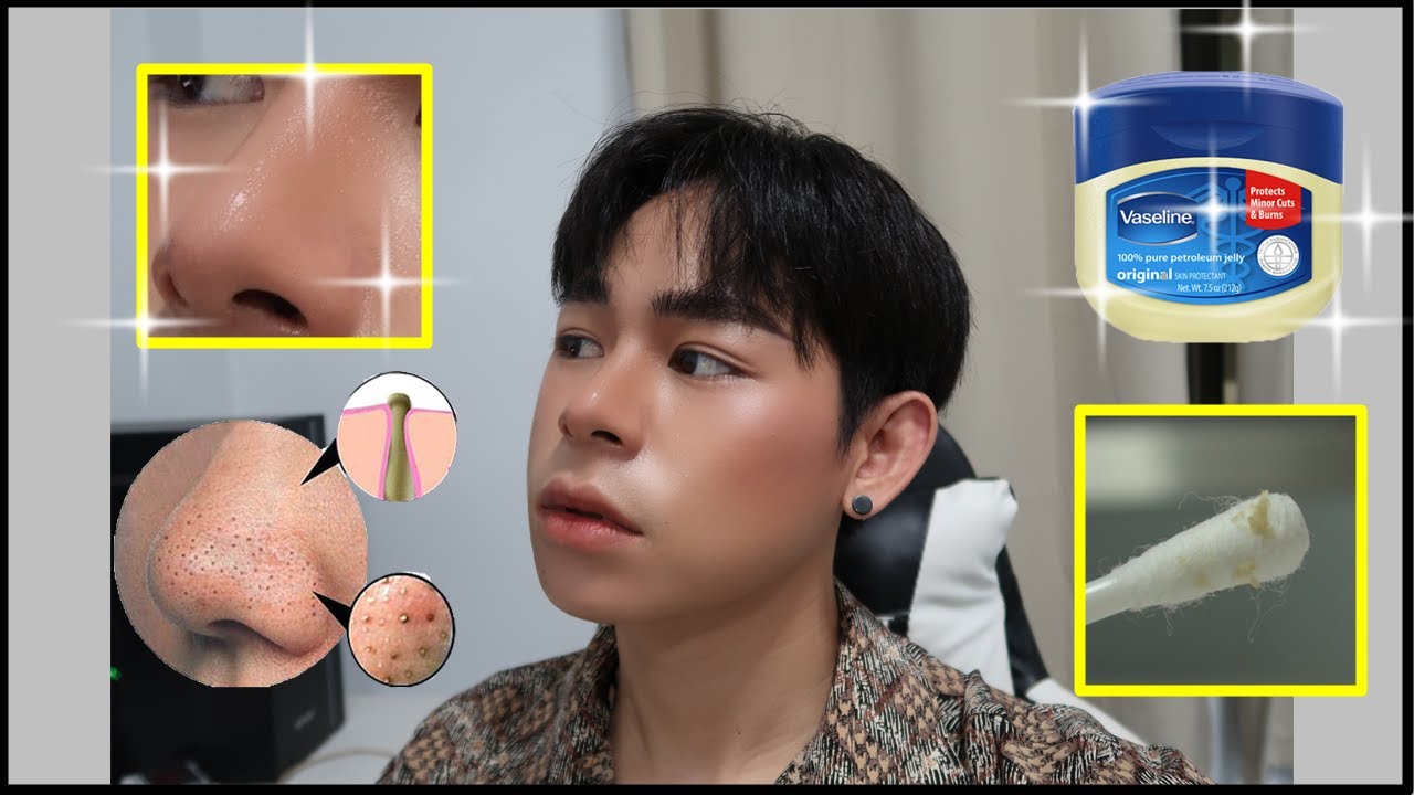 วิธี รักแร้ ขาว  New 2022  1 วิธีรักษาสิวเสี้ยนด้วยตัวเอง ด้วย Vaseline เห็นผลชัดเจ็น ทำเองได้ ! 으로 블랙헤드 제거? 진실 혹은 \