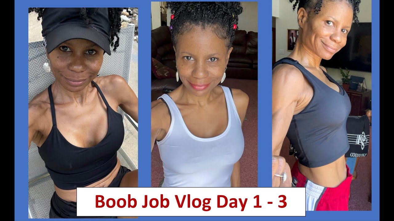 My Boob Job Surgery + Day 1 3 Vlog YouTube