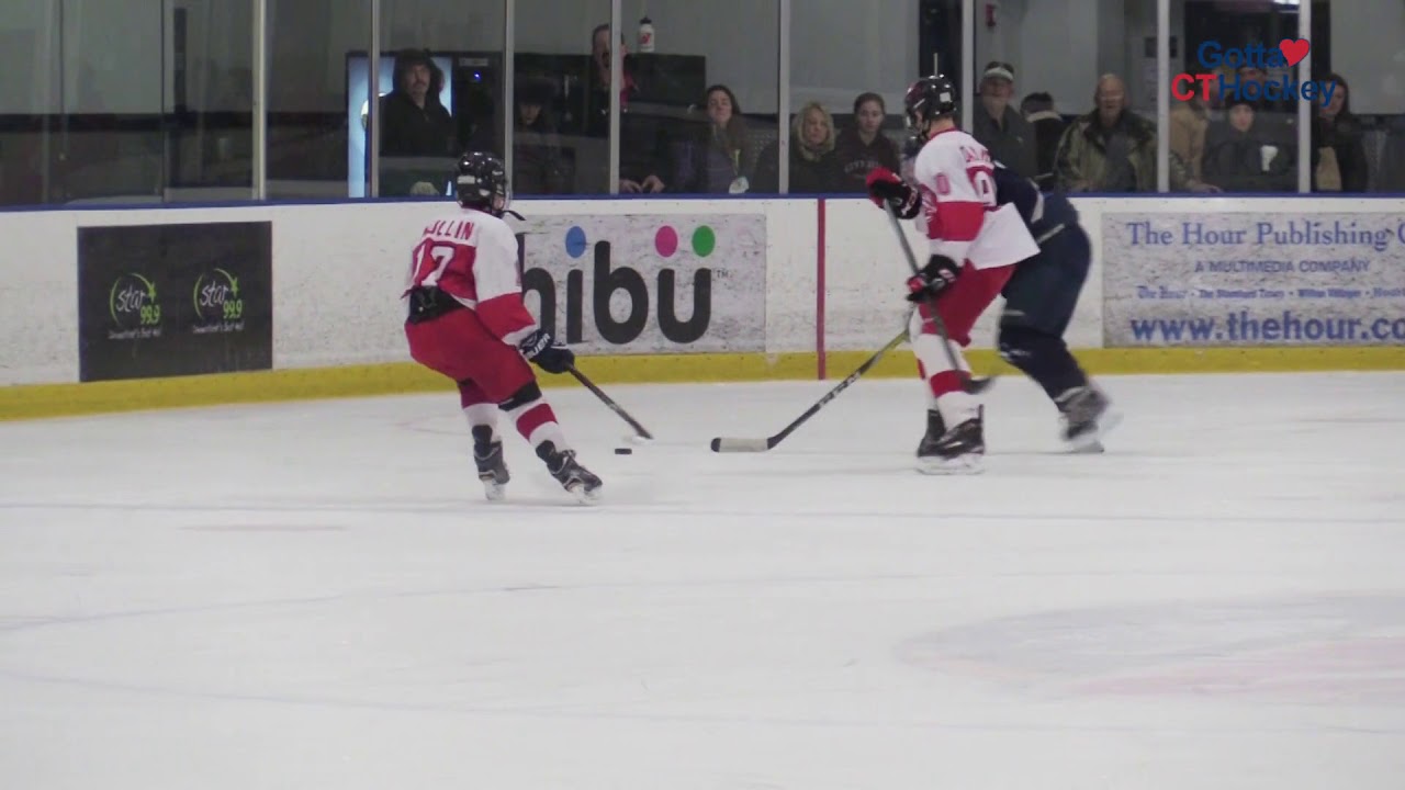 Concussions & Hockey: Should You Baseline Test Your Child?