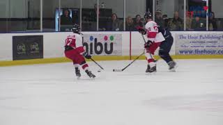 Concussions & Hockey: Should You Baseline Test Your Child?