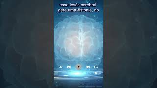 Diagnóstico de Distonia: Entenda Quando a Causa Aparece na Ressonância | Dr Diego de Castro