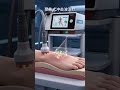#shockwavetherapy