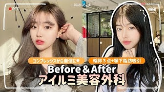整形ビフォーアフター Youtube