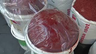 Şanlıurfa Da Acı Mesai