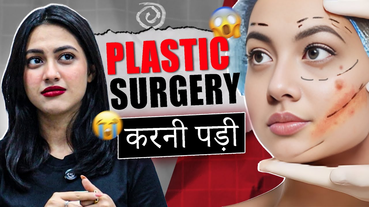 Reem Shaikh's SHOCKING Moment On National Television. #reemshaikh #accident #face #mamaraazzi