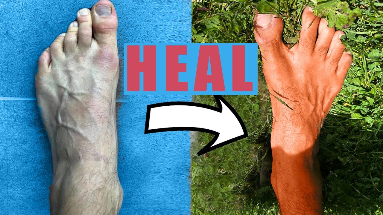 Barefoot Revolution: How This ONE Change Transforms The Body.