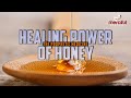 THE HEALING POWER OF HONEY 🐝