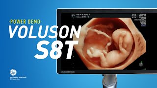 POWER DEMO - GE VOLUSON S8T