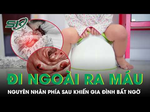 14-Year-Old Girl Suffers Prolonged Rectal Bleeding, Family Shocked by the Real Cause | SKDS