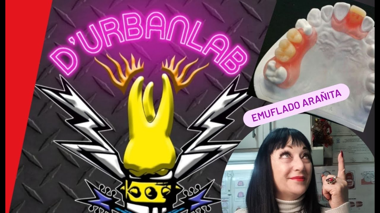 Como poner en mufla una arañita flexible. Emuflado DE PROTESIS