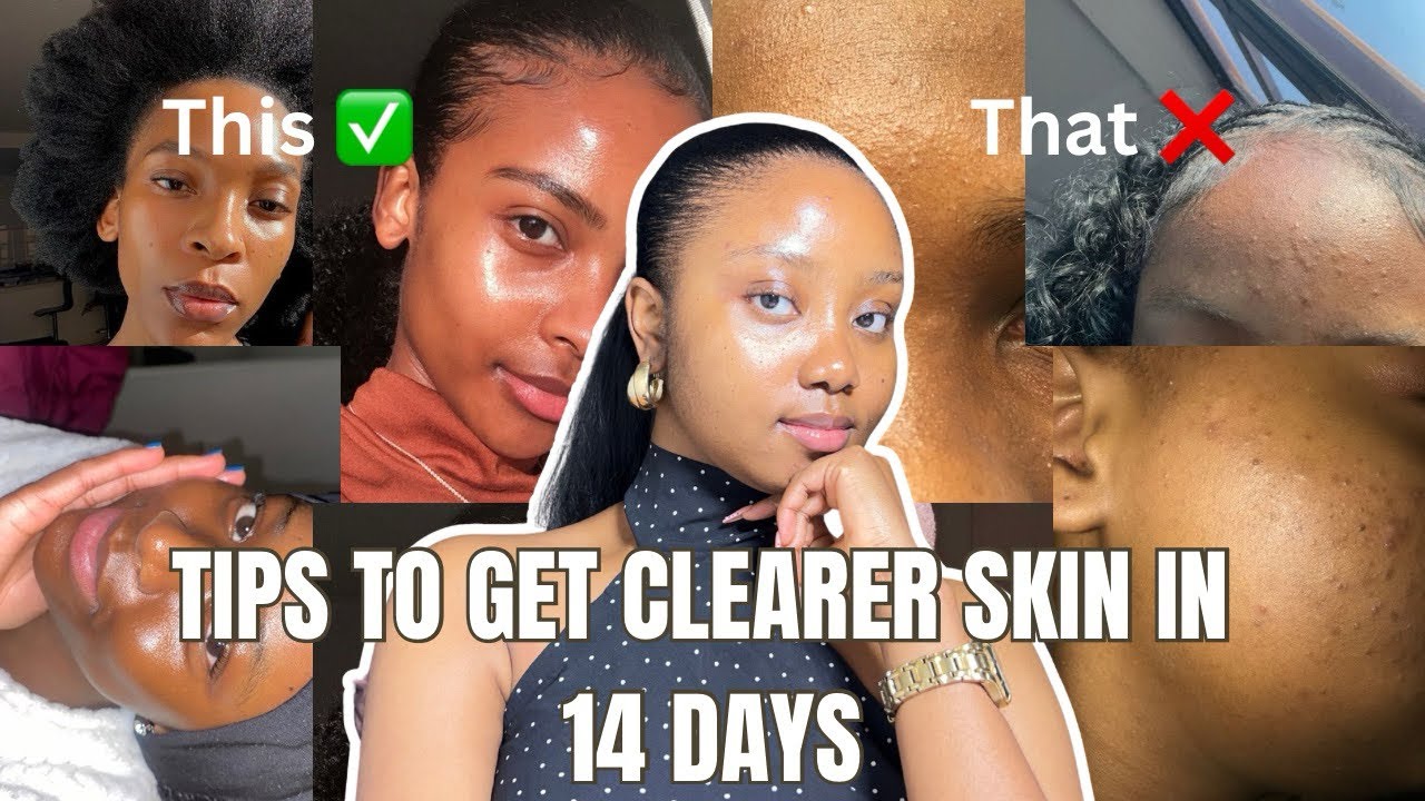 HOW TO IMPROVE YOUR SKIN IN 14 days | Realistic tips for a clearer skin ...