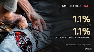 Do Tourniquets Cause Amputations? What the Evidence Actually Shows