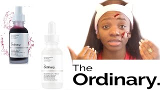 THE ORDINARY: Peeling rouge ft Niacinamide