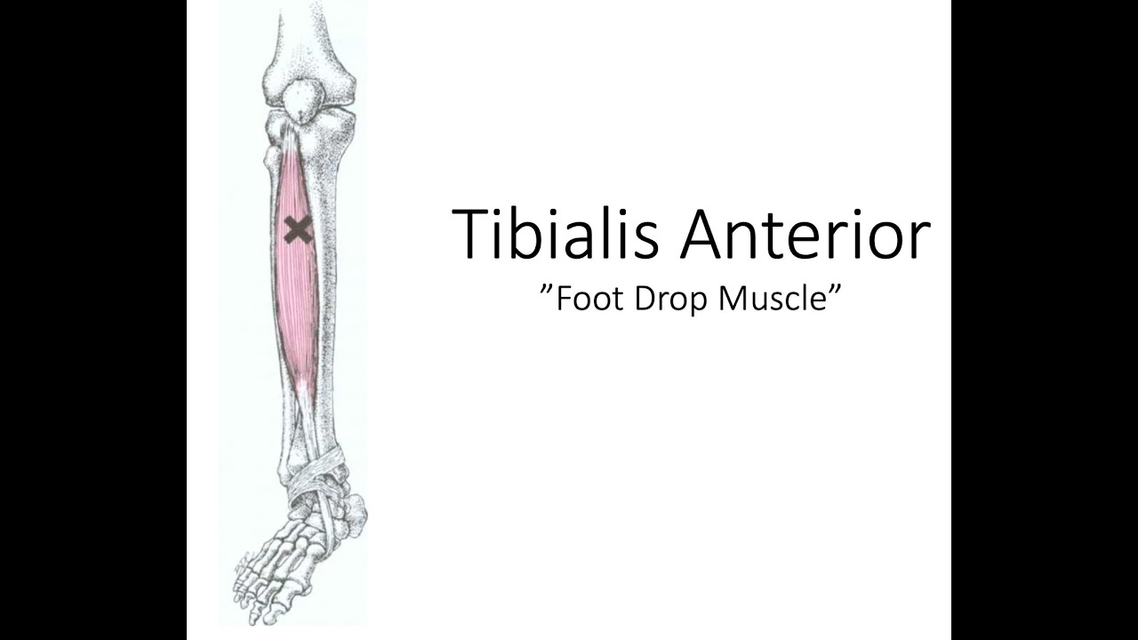 Tibialis Anterior: The “Foot Drop” Muscle | Referred Pain, Trigger Points, and Rehab Tips