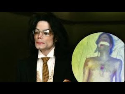 Video: Zakaj Je Michael Jackson Umrl