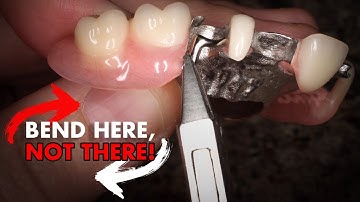 Bending Clasp Arms - One Minute Wisdom