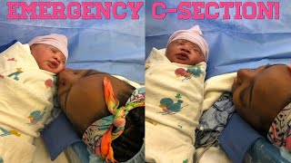 Emergency CSection | Birth Story pt 2