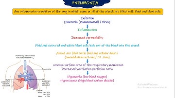 Pneumoniae. Respiratory Physiology. Chapterv63 part 3. Guyton and Hall Physiology.