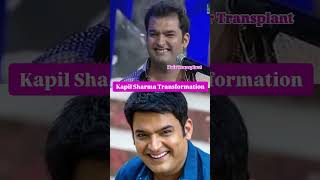 Kapil Sharma Smile Transformation 🦷 #kapilsharma #kapilsharmacomedy #bollywood #smile #shortsvideo