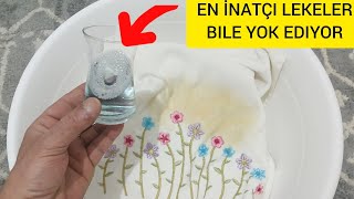 Asla Çıkmaz Dediğiniz Sandık Ve İç Çamaşırı Lekelerini Yok Eden Şaşırtıcı Yontem 😱🔥