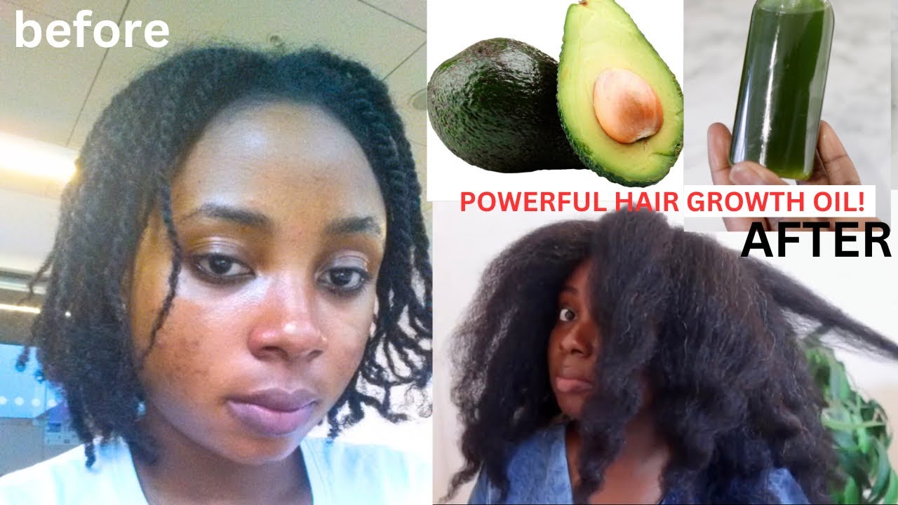 Не используйте это масло для волос, если вы не готовы к невероятному росту волос!