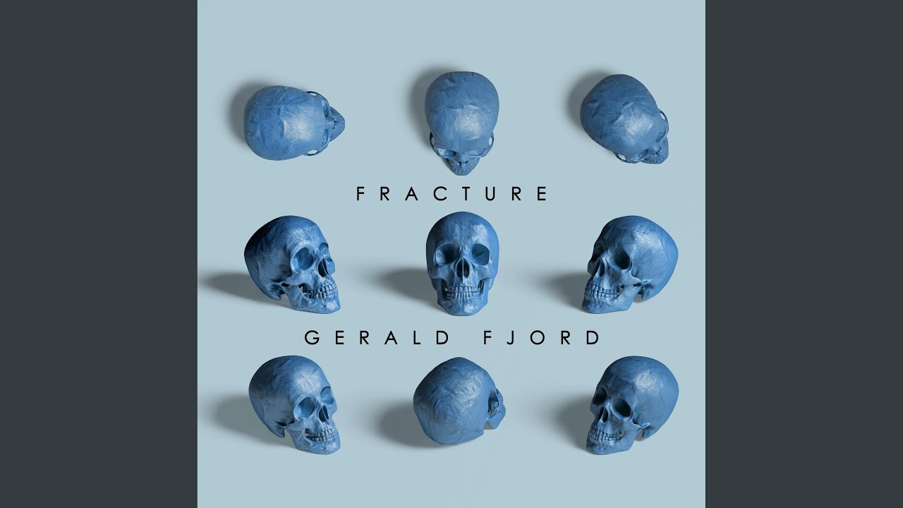 Guarda Fracture su YouTube Guarda Fracture su YouTube