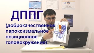 Доброкачественное позиционное пароксизмальное головокружение (ДППГ/BPPV)