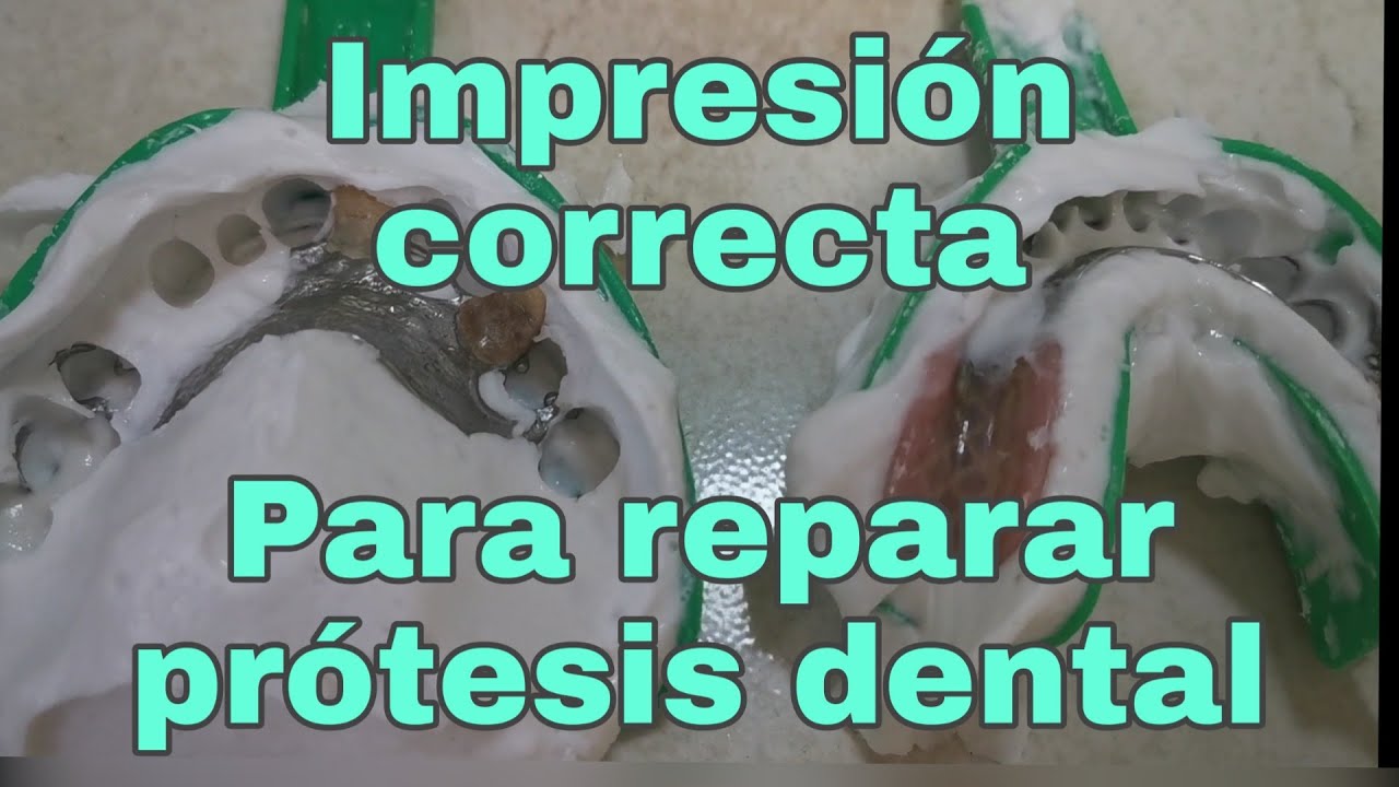 Impresiones dentales correctas para reparar prótesis dental