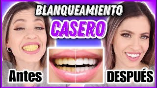 𝘽𝙇𝘼𝙉𝙌𝙐𝙀𝘼 𝙏𝙐𝙎 𝘿𝙄𝙀𝙉𝙏𝙀𝙎 EN MINUTOS CON ESTE REMEDIO CASERO FÁCIL Y RÁPIDO | NatyGloss