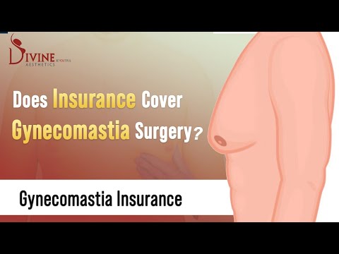 वीडियो: क्या गाइनेकोमास्टिया बीमा द्वारा कवर किया जाता है?