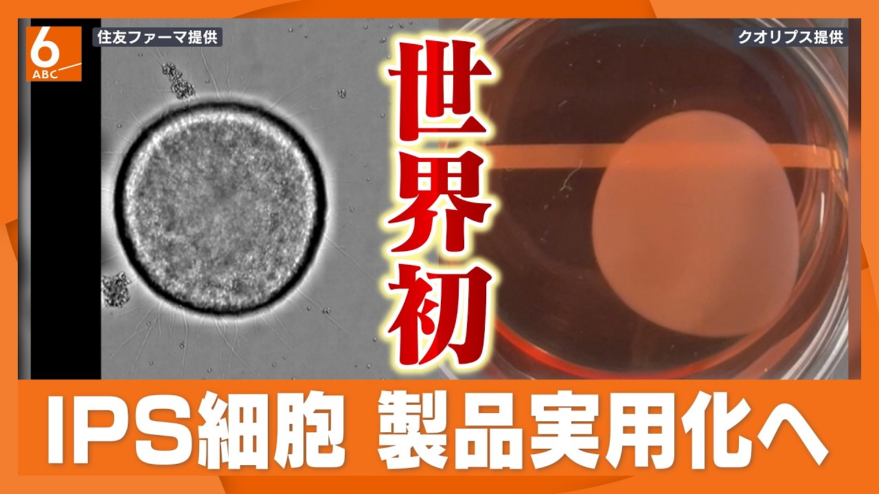 世界初の実用化へ！　iPS細胞由来の2つの再生医療製品が「了承」　ただ今はまだ“仮免許”の段階？　本承認に向けて越えるべきハードルは【有識者解説】