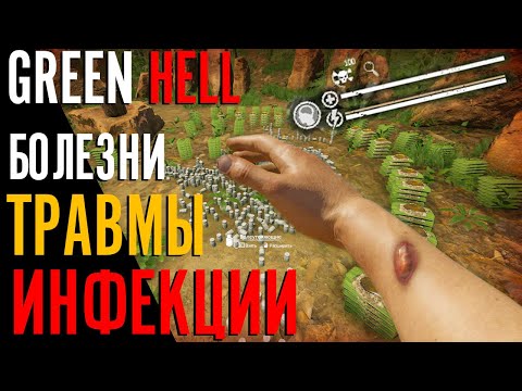 Видео: Как ЛЕЧИТЬ ТРАВМЫ, БОЛЕЗНИ, ИНФЕКЦИИ В Green Hell | Гайд