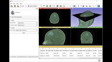 Segment statistics - new module in 3D Slicer