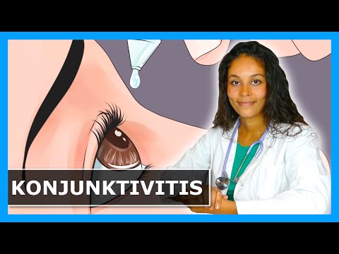 Video: Was ist eine gonorrhoische Konjunktivitis?