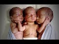 QUESTA MAMMA HA DATO ALLA LUCE 3 GEMELLI E HA SCOPERTO CHE È UN CASO SU 200 MILIONI