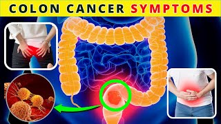 Never Ignore : 8 Critical Symptoms of Colon Cancer / SimoHealth by SimoHealth 16 views 3 months ago 9 minutes, 27 seconds