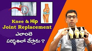 Hip & Knee Joint Replacement