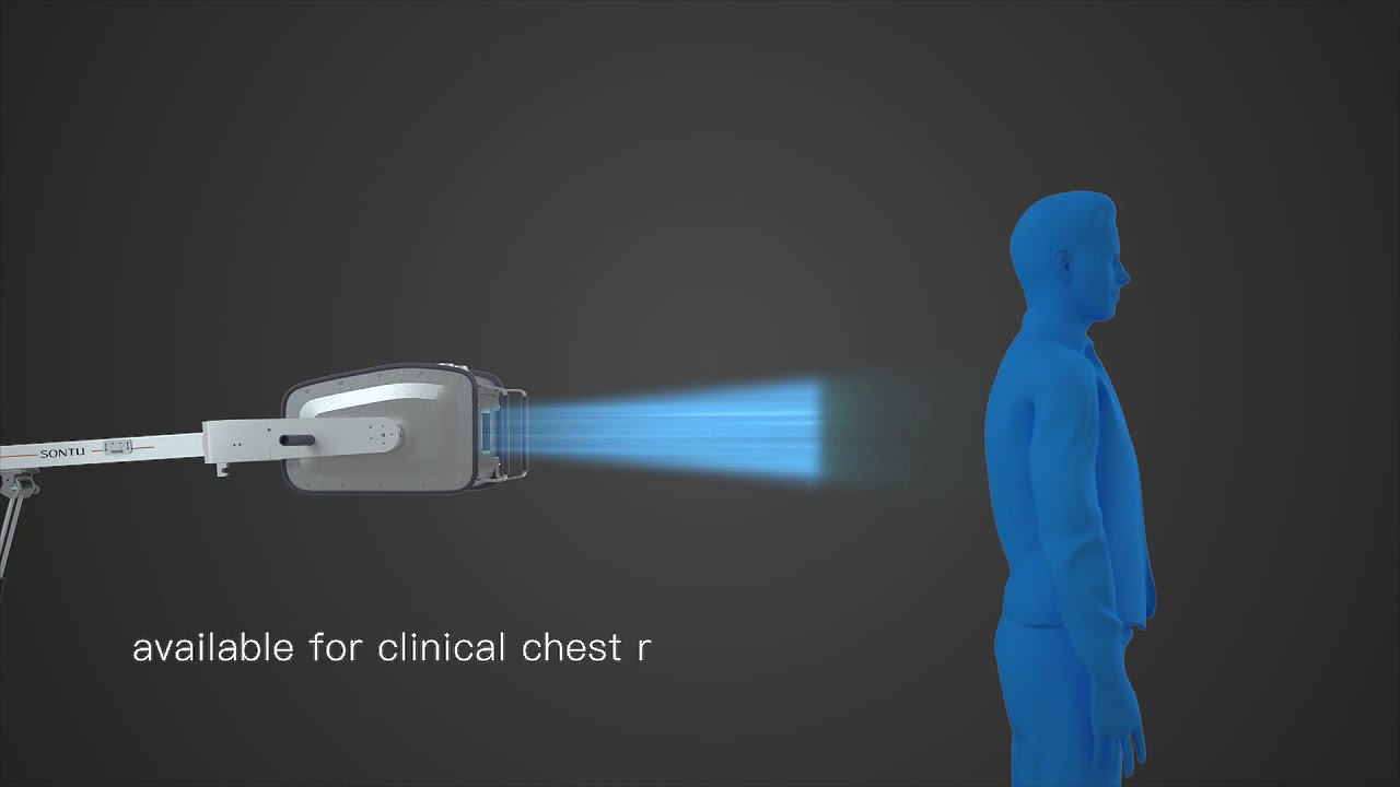 SONTU Portable X-ray DR System