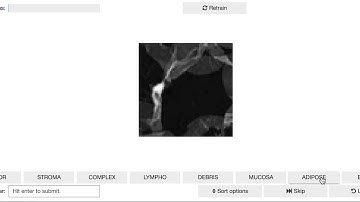 Using Active Learning to Label Images with Superintendent