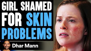 Girl Shamed For Skin Problems ft. Jamie Kern Lima | Dhar Mann