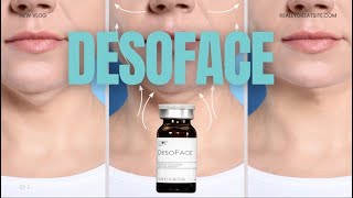 Double Chin & Jawline Contouring | Non-Surgical DESOFACE Treatment in Tunbridge Wells