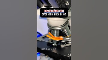 Snack que cay liệu có sạch không?🔬#kinhhienvi97 #Shorts #MicroScope