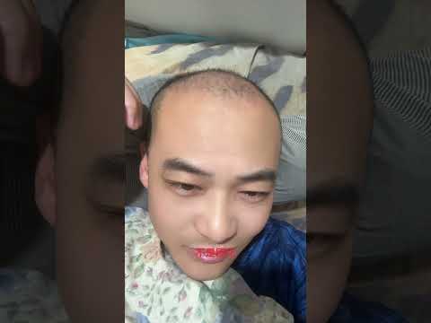 生发还没放弃！第二个疗程必须有效！#生发