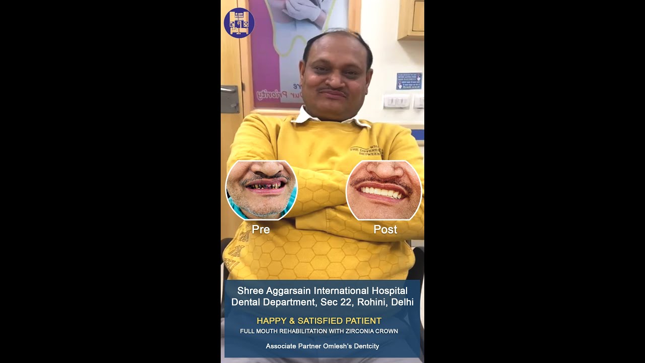 Full Mouth Rehabilitation with Zirconia Crowns | Complete Smile Transformation