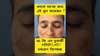 কালো দাগের জন্য কি করবেন pigmentation dermatologist melasma