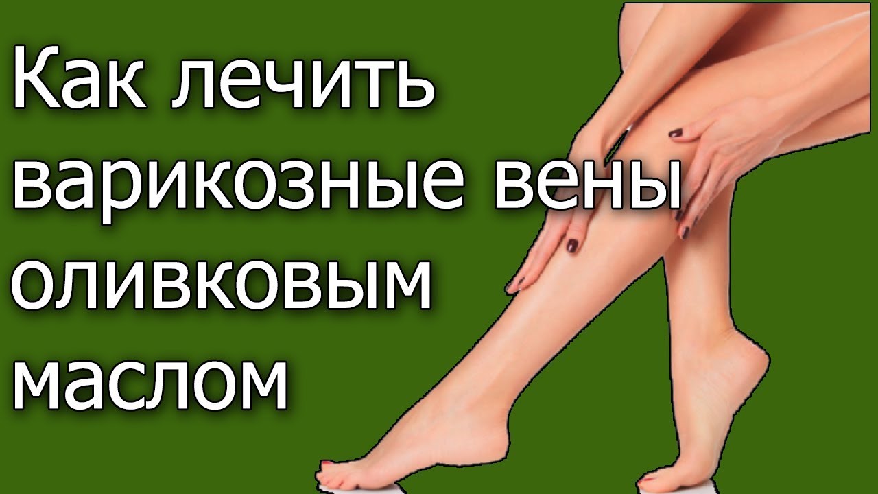 Как лечить варикозные вены оливковым маслом - YouTube