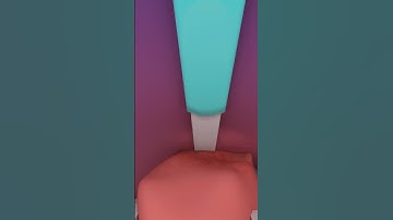 Piles surgery animation 3d video #shorts