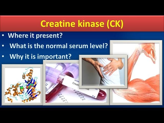 Creatine Kinase Average Blood Serum Levels Of Creatine Kinase And